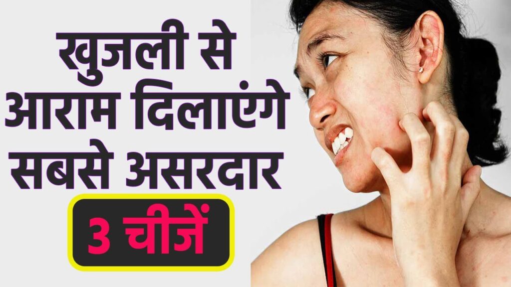 खुजली का इलाज | खुजली का घरेलू उपाय | khujli ka gharelu ilaj | boldsky