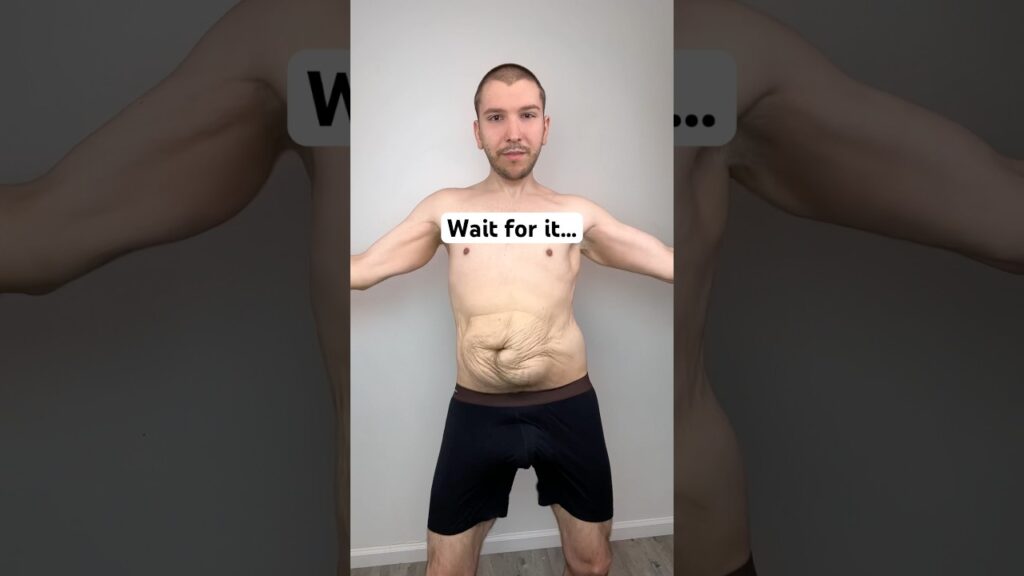 Skin removal reveal — 10 million views 😳