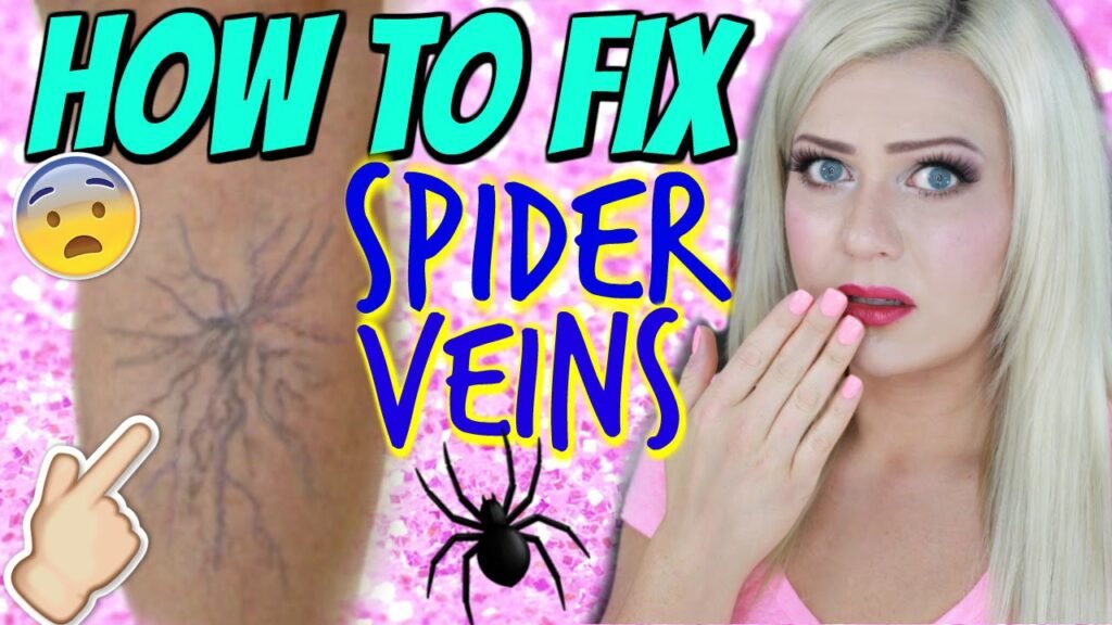 How to hide spider veins on your legs